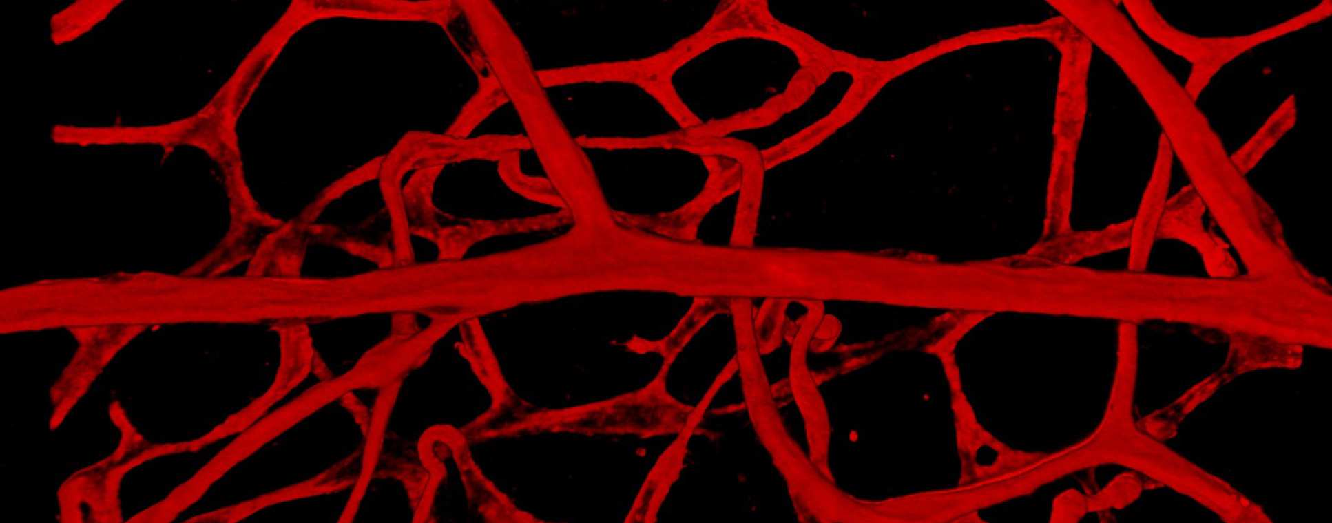 Section of Renal and Vascular Inflammation