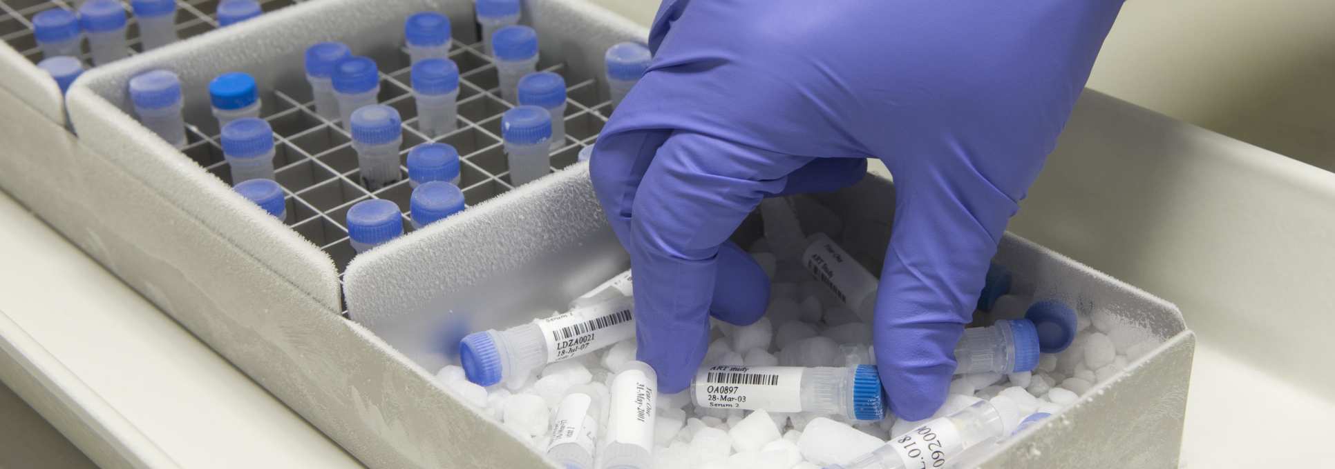 Hand reaching into frozen samples