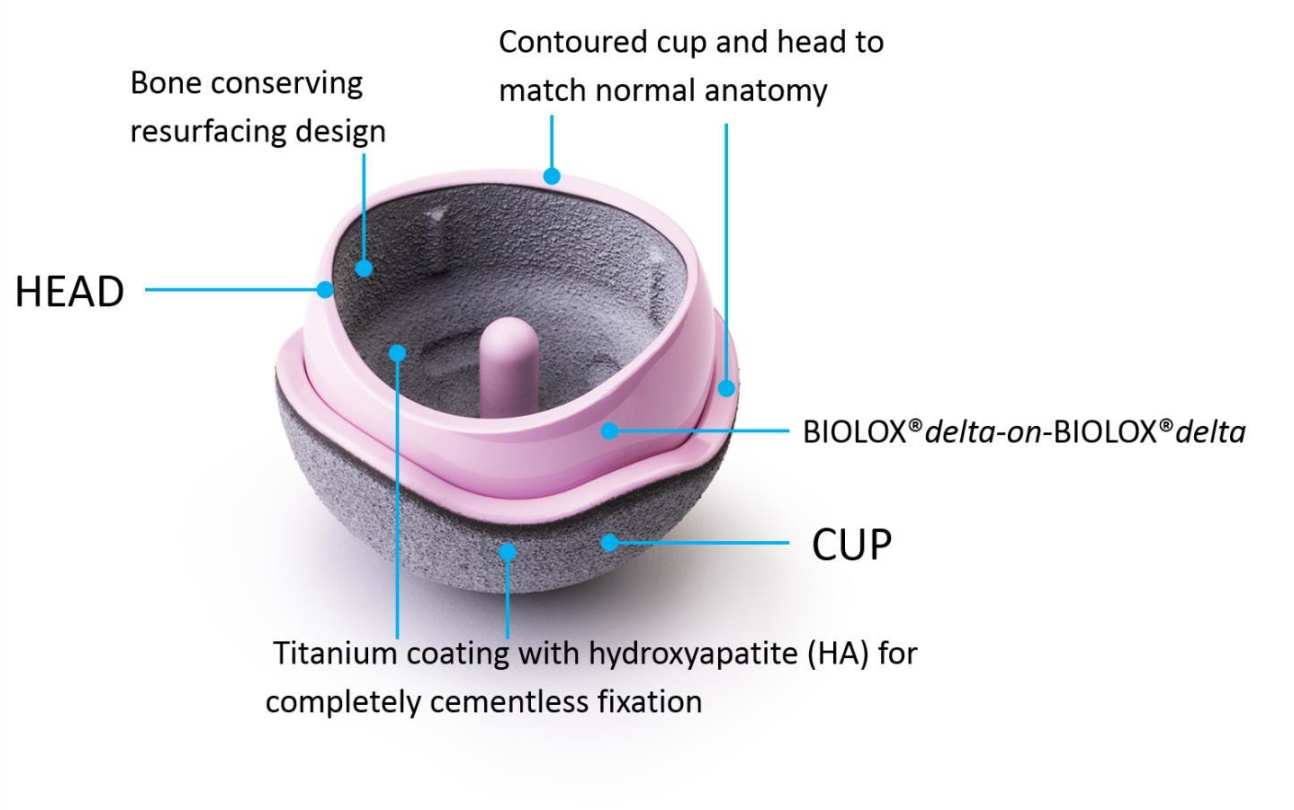 H1 Implant