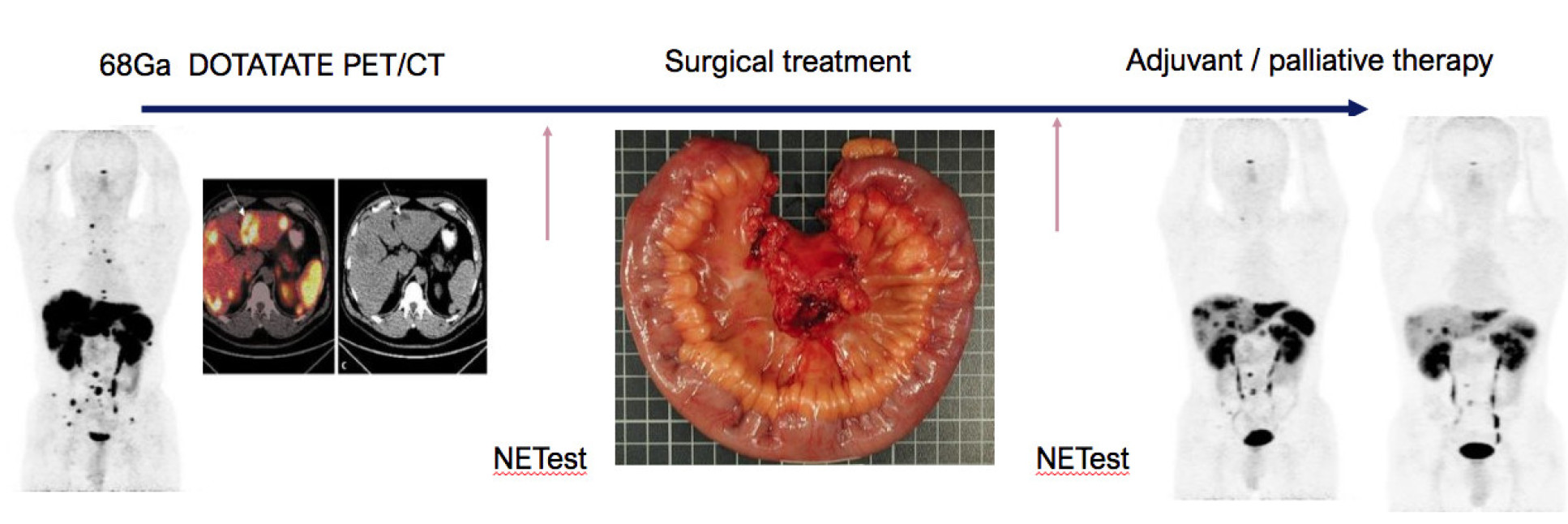 Incorporating novel markers within theranostic approaches to drive precision therapy  ​