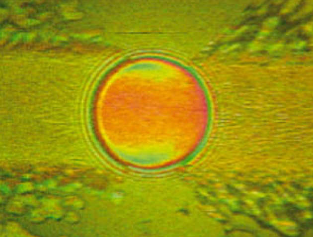 Optical interferometric image of grease lubricated film in a rolling contact 